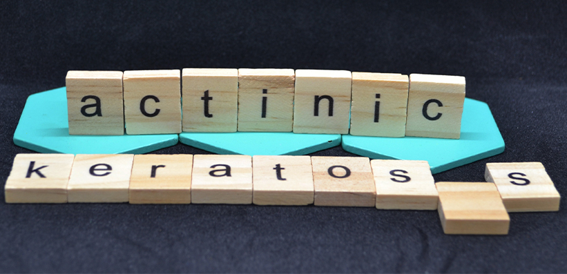 Bauklötze zeigen Aktinische Keratosen