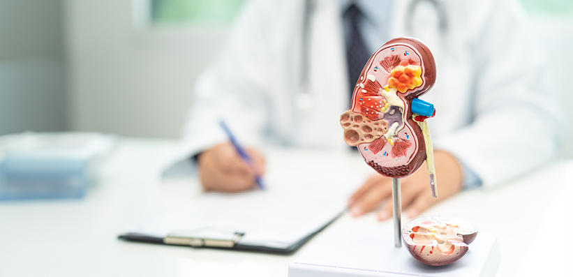 Nierenmodell mit Arzt im Hintergrund 