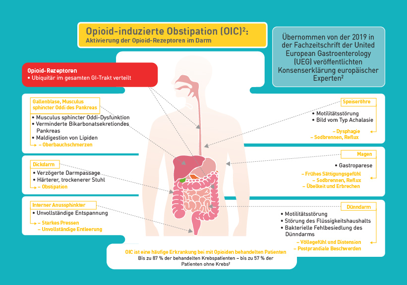 Schaubild zur Opioid-induzierten Obstipation mit der Verteilung der Opioid-Rezeptoren im Gastrointestinaltrakt